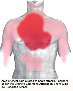 Area of the chest where pain associated with a heart attack may occur.